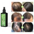100ml Hair Care oil hair grow Ginger Hair Growth