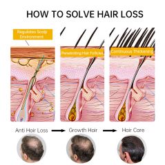 PURC Fast Hair Growth for Men Women Ginger Grow Hair Oil
