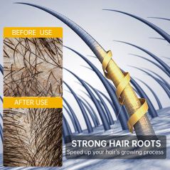 PURC Fast Hair Growth for Men Women Ginger Grow Hair Oil